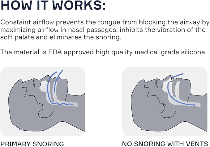 Nasal Dilators for Sleeping - 4 Medium (M) Anti Snoring Nose Vents - Soft Silicone Snore Stopper - Snoring Solution - Nasal Cones to Stop Snoring