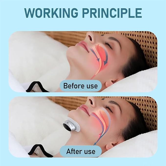 Anti Snoring Devices, Sleep Apnea Devices, Z3 Pro Professional Anti-Snoring Device, 3-Speed Adjustment, Smart Snoring Solution, Breathe Easy, Anti Snore, Sleep Soundly (10 Patches)
