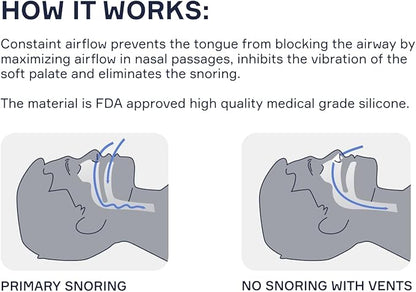 Nasal Dilators for Sleeping - 12 Nasal Cones for Breathing - Nostril Opener and Soft Silicone Nose Vents for Quiet Nights and Restful Sleep - Sinus Cones