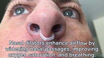 Nasal Dilators for Sleeping - 4 Medium (M) Anti Snoring Nose Vents - Soft Silicone Snore Stopper - Snoring Solution - Nasal Cones to Stop Snoring
