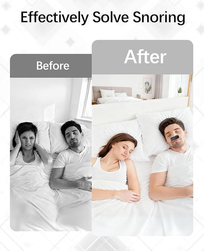 Anti Snoring Devices, Electric Snoring Solution with Adjustable Security Strap, Adjustable 6-Speed, Universal Fit for All Nose Shapes, Portable Sleep Apnea Devices for Men & Women (Charcoal Black)