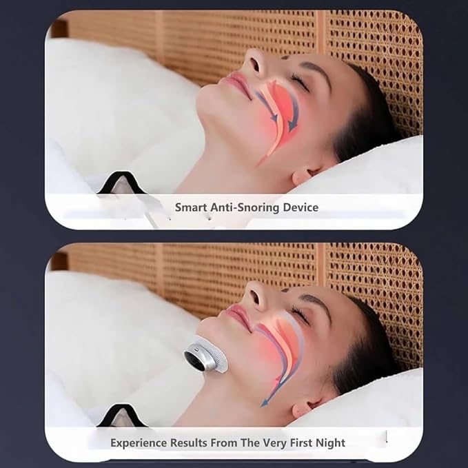 Z3 Pro - Professional Anti-Snoring Device, Z3 Pro Snoring Solution, NovaNord Z3 Pro Snoring Solution, Fast and Effective Smart Z3 Pro Sleep Device, 3-Speed Adjustment，Sleep Soundly(1pcs)