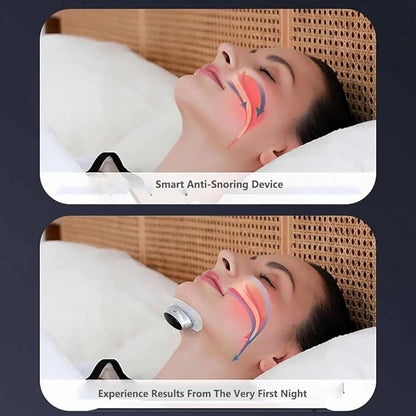 Z3 Pro - Professional Anti-Snoring Device, Z3 Pro Snoring Solution, NovaNord Z3 Pro Snoring Solution, Fast and Effective Smart Z3 Pro Sleep Device, 3-Speed Adjustment，Sleep Soundly(1pcs)