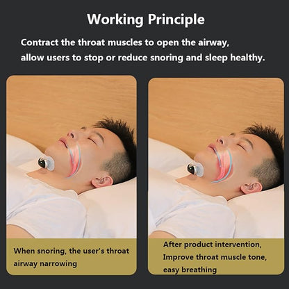 Electric Anti Snoring Device for Sleep Apnea Smart Throat Anti Snoring Device with Fixing Strap Snore Stopper Mouthpiece Snoring Solution Machine for Better Sleep