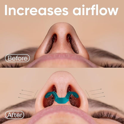 Brison Nasal Dilators for Breathing and Sleeping - 3 Pack Anti Snoring Nose Vents Opener for Better Breathing Sleeping and Activity Improves Airflow - Soft