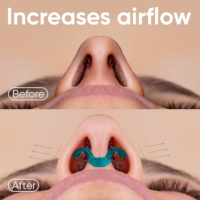 Brison Nasal Dilators for Breathing and Sleeping - 3 Pack Anti Snoring Nose Vents Opener for Better Breathing Sleeping and Activity Improves Airflow - Hard