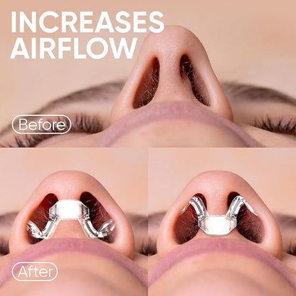 Brison Nasal Dilators for Breathing and Sleeping - 3 Pack Anti Snoring Nose Vents Opener for Better Breathing Sleep ing and Activity Improves Airflow - Hard, Transparent