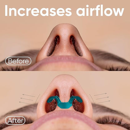 Brison Nasal Dilators for Breathing and Sleeping - 2 Pack Anti Snoring Nose Vents Opener for Better Breathing Sleeping and Activity Improves Airflow - 2pcs