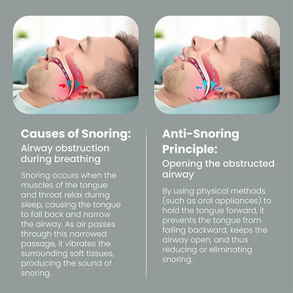 Tongue Stabilizing Device Mouthpiece - Reusable, BPA-Free Anti Snore Solution & Comfortable Tongue Retainer to Stop Snoring for Better Sleep, Fits Men & Women-D04
