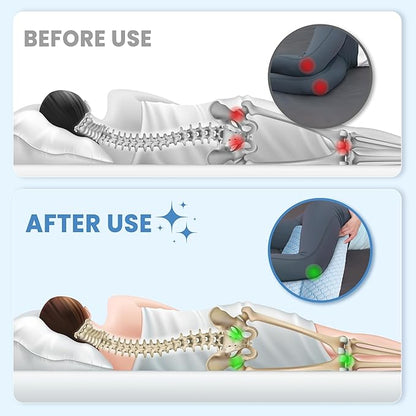 puredown® Knee Pillow for Side Sleepers, Leg Elevation Pillow for Side Sleeping, Pillow Between Legs for Aligns Spine, Support for Pregnancy Relieves Pressure Hip Leg and Improve Sleeping, Blue