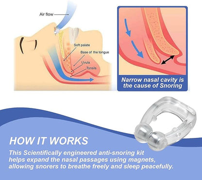 Pack of 6 Magnetic Anti-Snore Clips - Silicone Nose Clips - Reusable Snoring Solution for Nasal Snorers - Enjoy a More Peaceful Night's Sleep - by Mobi Lock
