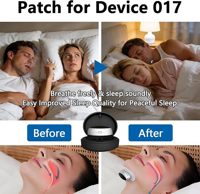 Anti Snoring Device Electrode Plate, 10-Pack Replacement Pads for Electric Anti Snore Stopper Machine Accessories