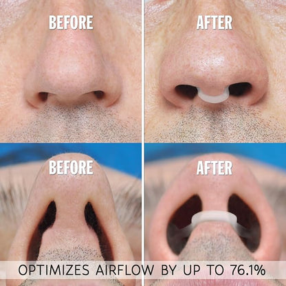 AIRMAX Nasal Dilator for Better Sleep - Natural, Comfortable, Anti Snoring Device, Snoring Solution for Maximum Airflow and Easier Breathing 2 Size Trial Pack (Small and Medium - Clear)