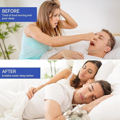 Anti Snoring Devices, Anngola Snoring Solution, Silicone Magnetic Anti Snoring Nose Clip, Effective Hale Breathing Aid, Stop Snoring to Restful Sleep(10 Pack)