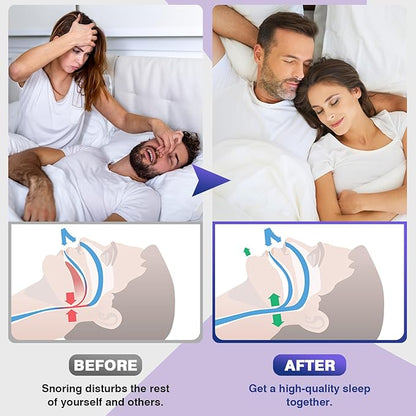 Anti Snoring Devices, Snore Stopper with Adjustable Magnet, Silicone Nose Clip Stop Snoring, Effective to Relieve Snoring, Snoring Solution for Comfortable and Quieter Sleep, White,M