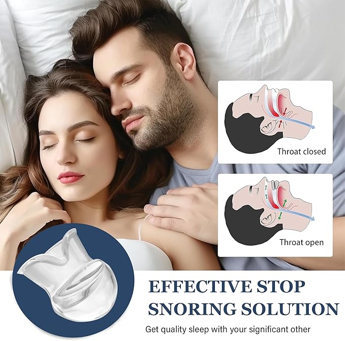 Snoring Solution - Anti-Snore Device, Reusable Snore Solution Stopper for Men/Women - MF22