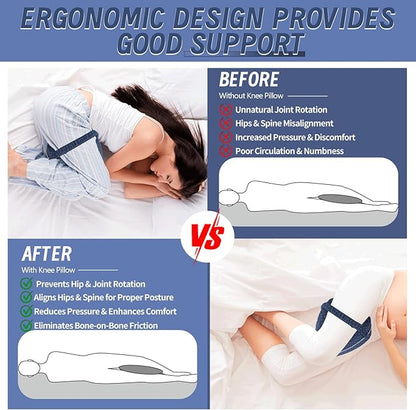 Knee Pillow for Side Sleepers, Ergonomic Leg Pillow for Side Sleeping, Sciatica Pain Relief Pillow for Soothing, Memory Foam Support Suitable for Back, Leg, Knees, Ankle Joints and Spine