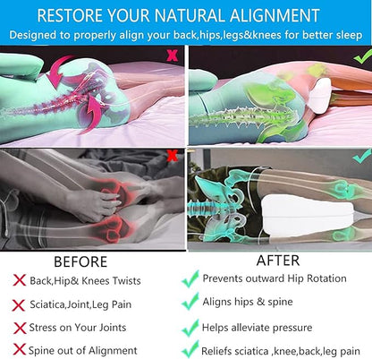 Leg Pillow, Knee Pillow for Side Sleepers, Leg Pillows for Sleeping, Knee Cushion for Sleeping,Suitable for Relieving Leg, Back, Knee Pain