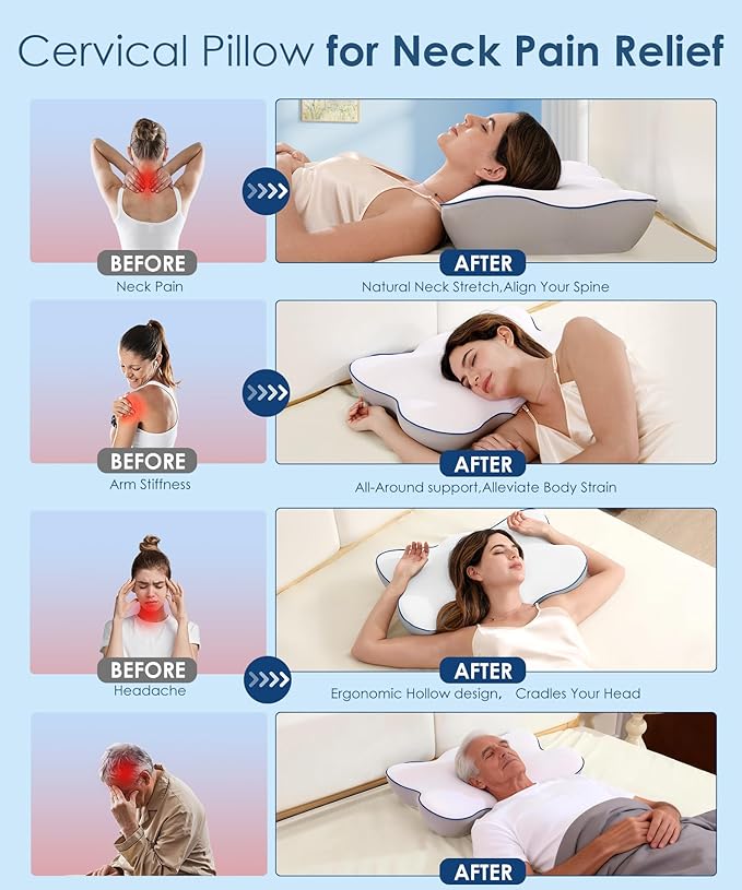 Cervical Neck Pillow for Pain Relief, Ergonomic Side Sleeper Pillow for Neck Support, Cooling Memory Foam Pillows Contour Orthopedic Bed Pillow for Back Stomach Sleepers (White)