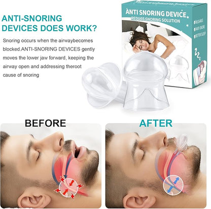Anti Snoring Device - Snoring Solution Mouth Guard for Men and Women -VV04