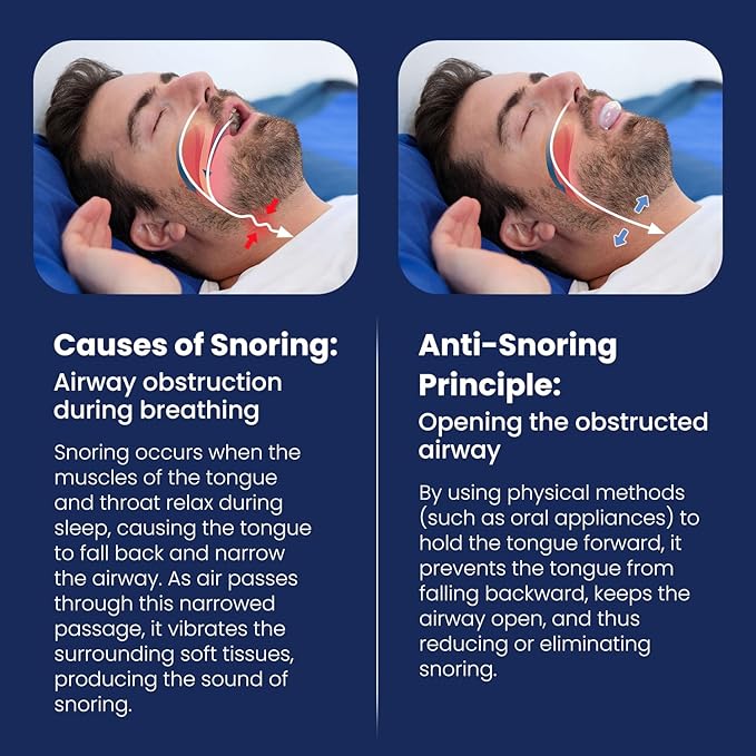 Tongue Stabilizing Device Mouthpiece - Reusable, BPA-Free Anti Snore Solution & Comfortable Tongue Retainer to Stop Snoring for Better Sleep, Fits Men & Women(L)