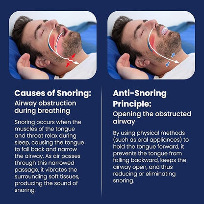 Tongue Stabilizing Device Mouthpiece - Reusable, BPA-Free Anti Snore Solution & Comfortable Tongue Retainer to Stop Snoring for Better Sleep, Fits Men & Women(L)