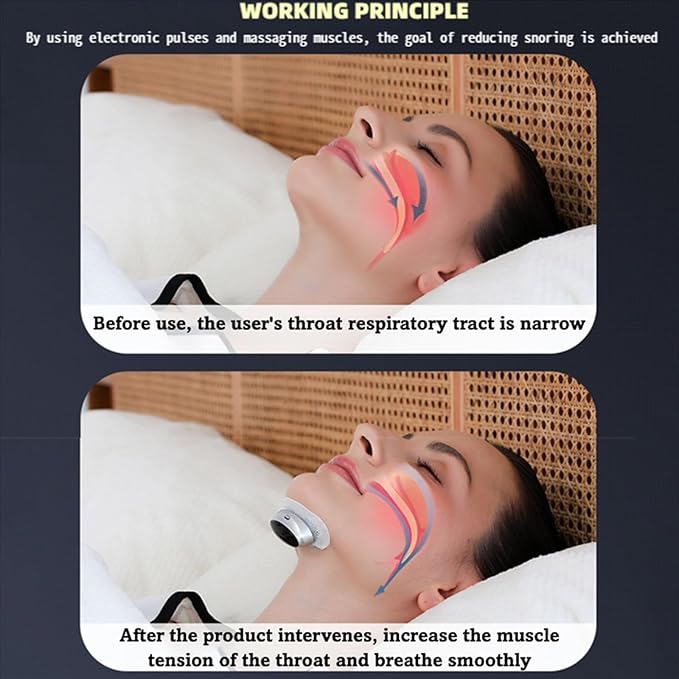 Z3 Pro Snoring Solution – Anti Snoring Devices (10 Self-Adhesive Patches)