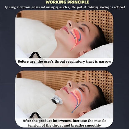 Z3 Pro Snoring Solution – Anti Snoring Devices (10 Self-Adhesive Patches)