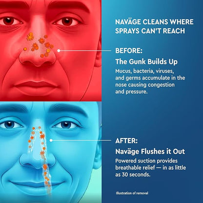Navage Multi-User Bundle - Navage Irrigation System - Saline Nasal Rinse Kit with 1 Nose Cleaner, 30 Salt Pods, and Extra Nasal Dock and Pair of Nose Pillows