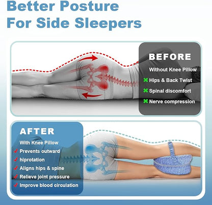 Knee Pillow for Side Sleepers, Leg Pillow for Sleeping, Knee Pillow with Strap, Alignment Pillow Between Legs, Suitable for Relieving Leg, Back & Knee Pain, Machine Washable (Blue)