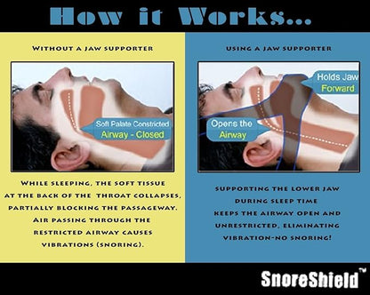 SnoreShield Anti Snore Chin Strap - The #1 Ranked Snoring Sleep Solution - Natural And Comfortable Instant Snore Stopper - Easy To Use And Adjustable