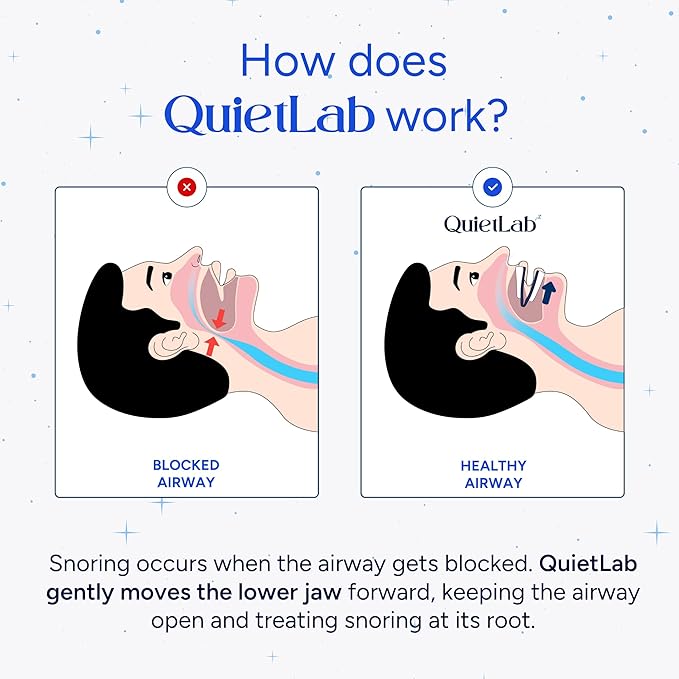 QuietLab Pro Anti-Snoring Mouthpiece - Adjustable Snoring Mouth Guard, Orthodontist Designed, No Boiling Required - BPA-Free Medical Grade - Designed for Nighttime Snoring Control