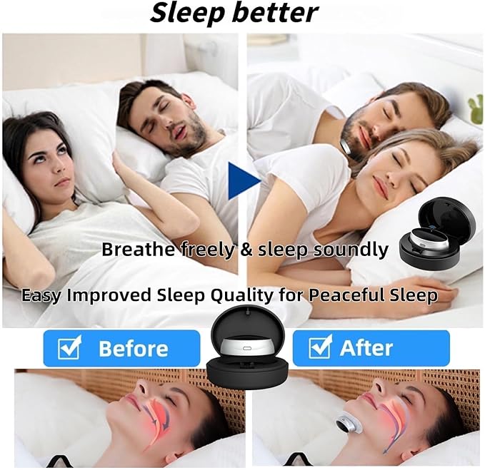Z3 Pro Snoring Solution, Z3 Pro Anti Snoring Device, 3 Adjustable Levels, 2025 Best Novanord Z3 Pro Snoring Solution, Breathe Easy, Sleep Soundly (30 Patches)
