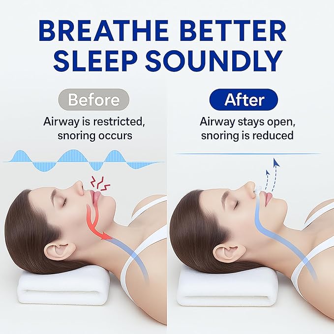 Anti Snoring Devices, Adjustable Snore Stopper for Men and Women, Snoring Solution, Individually Packaged & Reusable – 4 Pack