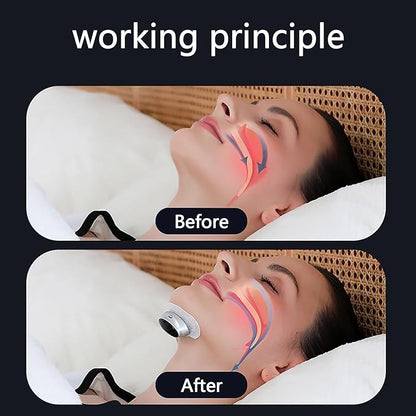 Anti-Snoring Aid - Portable 3-Speed Adjustable Device for Better Sleep, Comfortable & Easy to Use (Black)