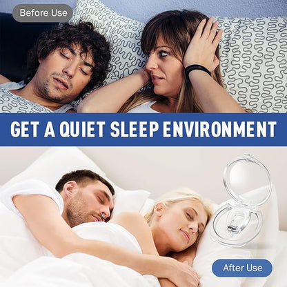 Anti Snoring Devices, Snore Stopper with Adjustable Magnet, Nasal Dilators Silicone Nose Clip Stop Snoring, Effective to Relieve Snoring, Snoring Solution for Comfortable and Quieter Sleep, M