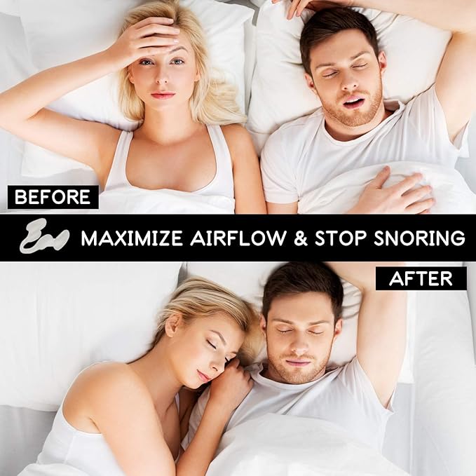 AIRMAX Nasal Dilator for Better Sleep - Natural, Comfortable, Anti Snoring Sleep Aid Solution for Maximum Airflow and Easier Breathing (Small - Clear)