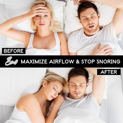 AIRMAX Nasal Dilator for Better Sleep - Natural, Comfortable, Anti Snoring Sleep Aid Solution for Maximum Airflow and Easier Breathing (Small - Clear)