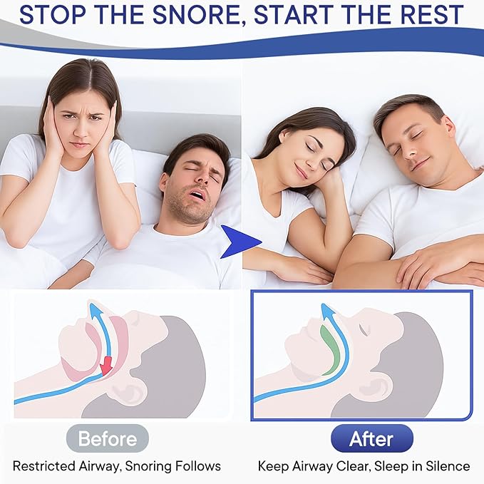 Anti Snoring Devices, Nose Vents Opener for Men and Women, 3-Gear Adjustable Fit, Individually Packaged & Portable, Helps Improve Airflow – 4 Pack
