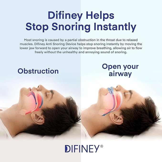 Anti Snoring Device: FDA-Cleared Anti Snoring Mouthpiece Mouth Guard - Effective Anti Snore Solution for Men and Women to Reclaim Peaceful Sleep (Blue)