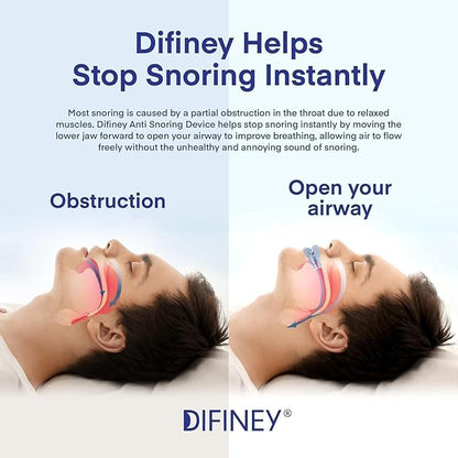 Anti Snoring Device: FDA-Cleared Anti Snoring Mouthpiece Mouth Guard - Effective Anti Snore Solution for Men and Women to Reclaim Peaceful Sleep (Blue)