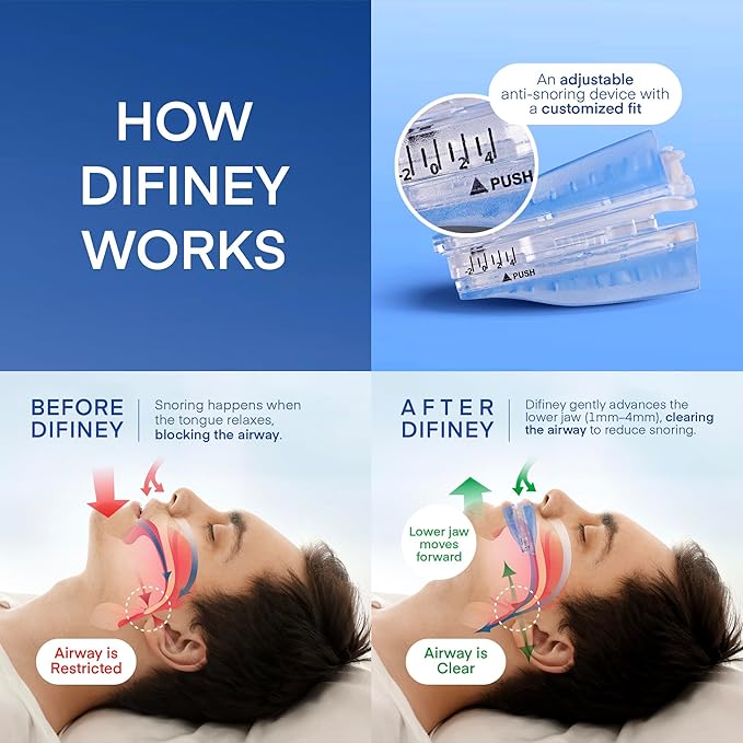 Anti Snoring Device: FDA-Cleared Snoring Solution – Adjustable Snore Stopper Mouth Guard for Men & Women – Anti Snoring Mouthpiece to Improve Sleep – Reusable Night Use