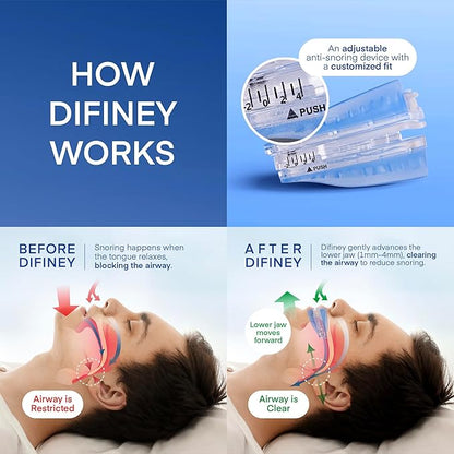Anti Snoring Device: FDA-Cleared Snoring Solution – Adjustable Snore Stopper Mouth Guard for Men & Women – Anti Snoring Mouthpiece to Improve Sleep – Reusable Night Use