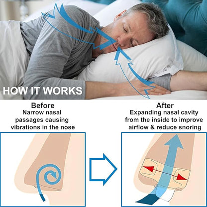 Nasal Dilators for Sleeping & Breathing - 4 Pack Anti Snoring Nose Clip to Improve Airflow & Snoring - Nose Opener Anti Snoring Devices for Men and Woman